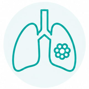 Lung Cancer